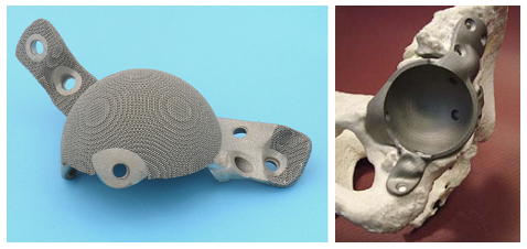 Photograph of titanium acetabular