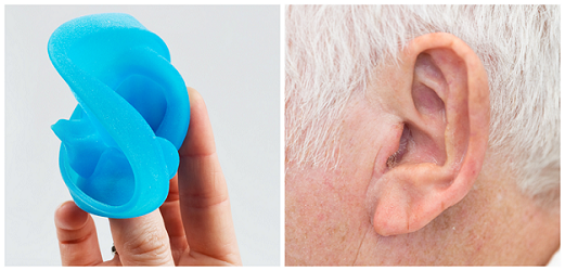 Photograph of the 3D printed prosthetic ear